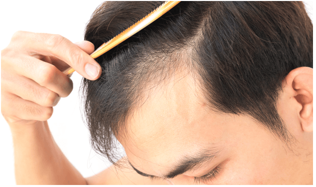 Care for Hair Transplant Recovery