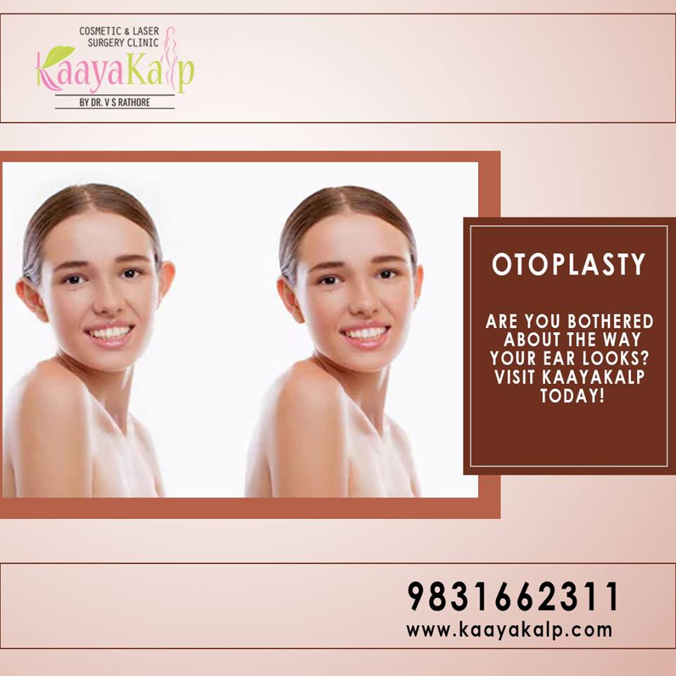 Facts About Otoplasty Surgery