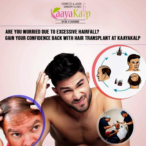 Kaayakalp- The One Stop Solution For Hair Reconstruction Surgery