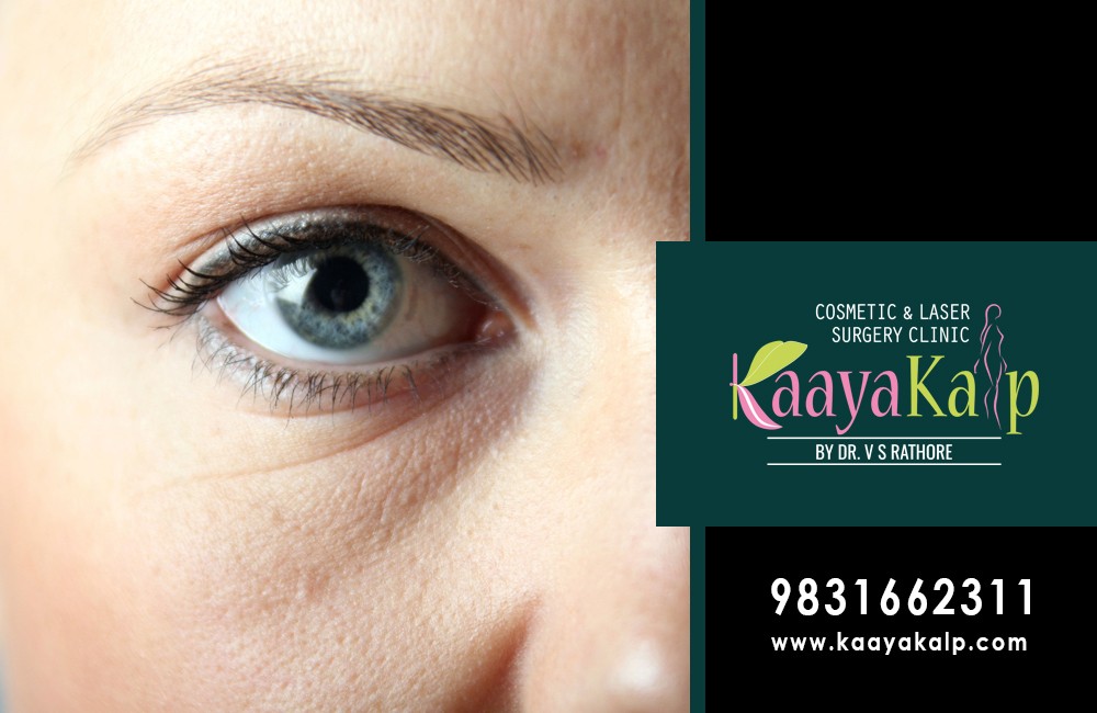 Eye Bag Surgery By The Best Cosmetic Surgeon in Kolkata