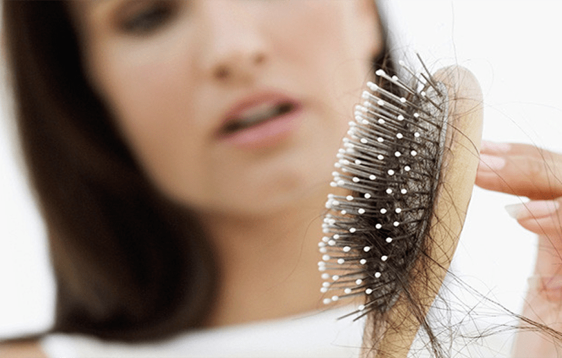Top Causes of Hair Loss