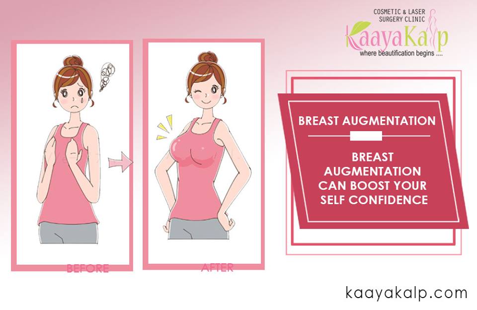 Breast Augmentation Facts- Know Before Opting For The Surgery