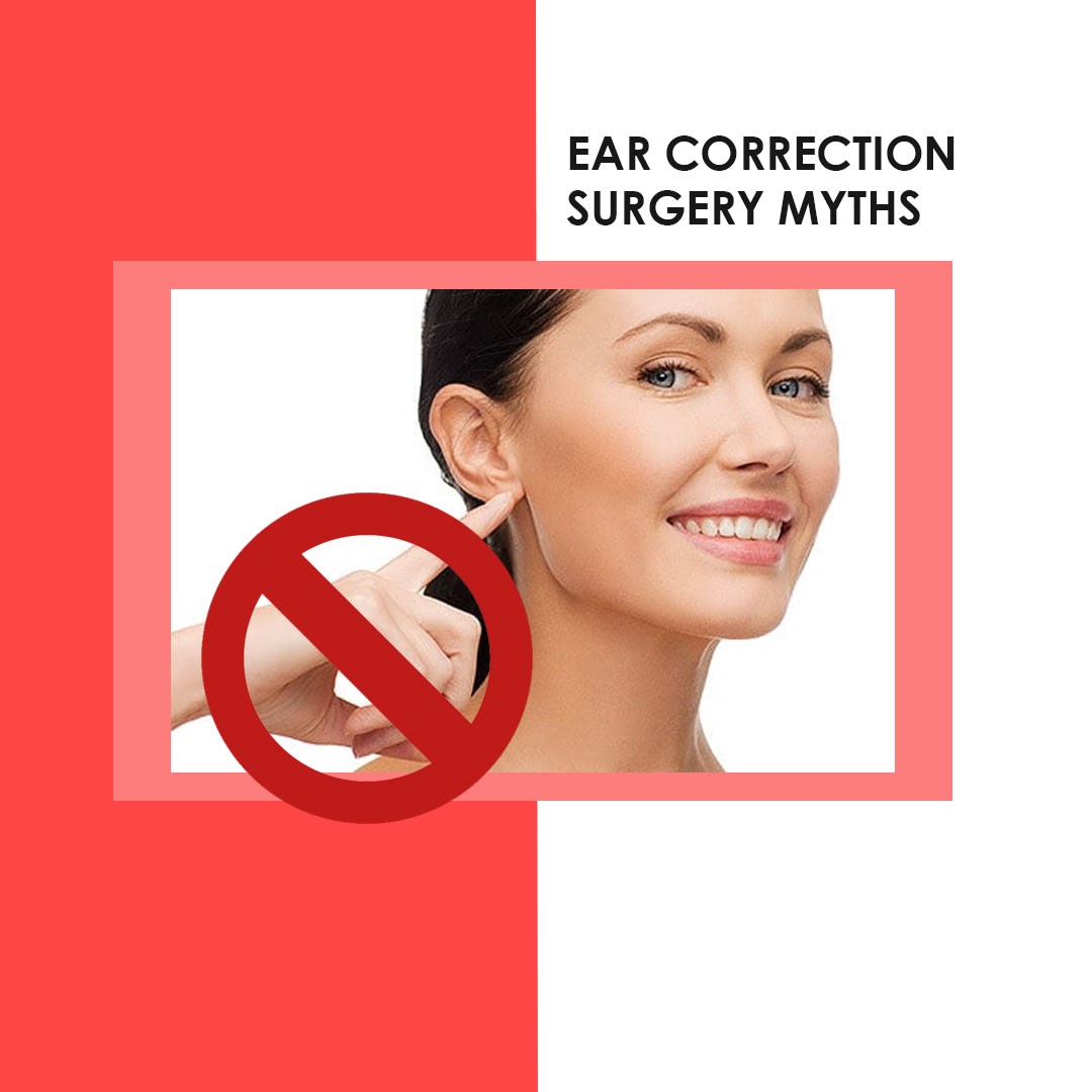Ear Correction Surgery- Myths Debunked!