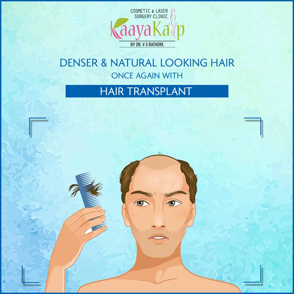 Get Natural Looking Hair with FUE Hair Transplant