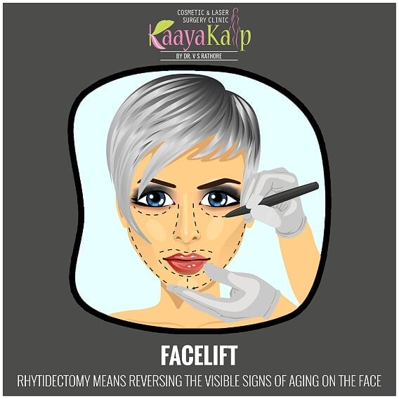 Why facelift surgery in India is a better option to get it done?