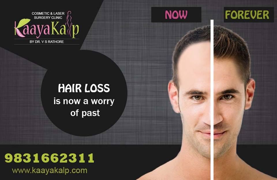 The Difference between Hair Transplant and Hair Weaving