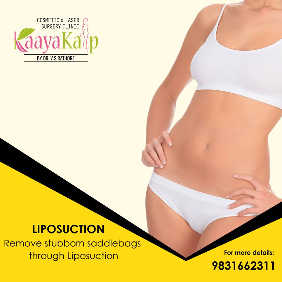 Is liposuction worth it ?