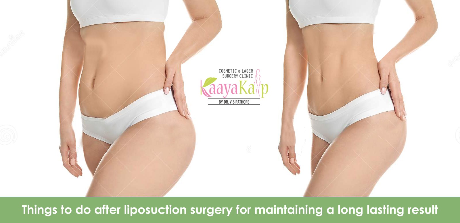 What to do after liposuction surgery ?