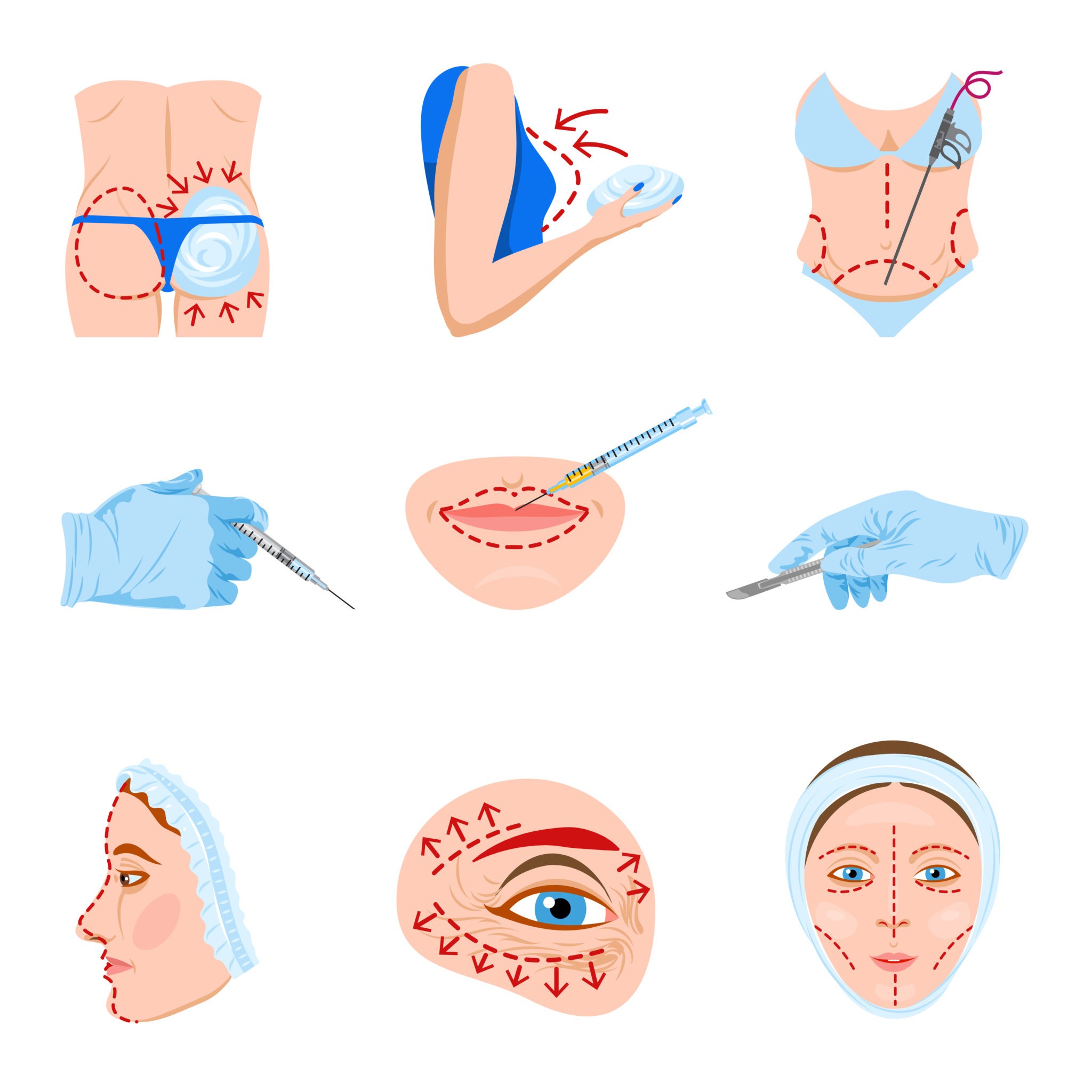Types of Cosmetic Surgeries