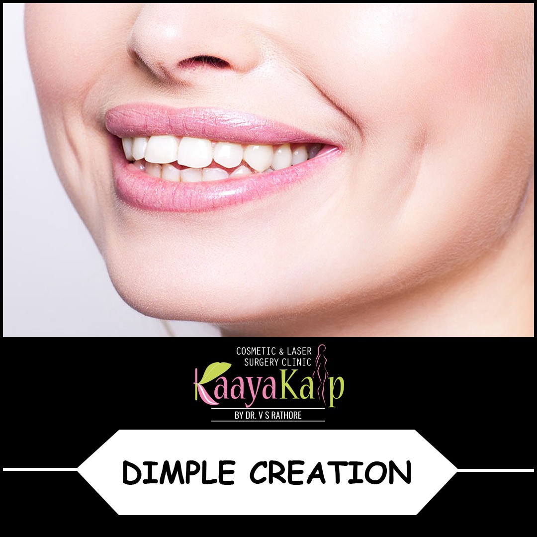 How dimpleplasty creates dimple on cheek?