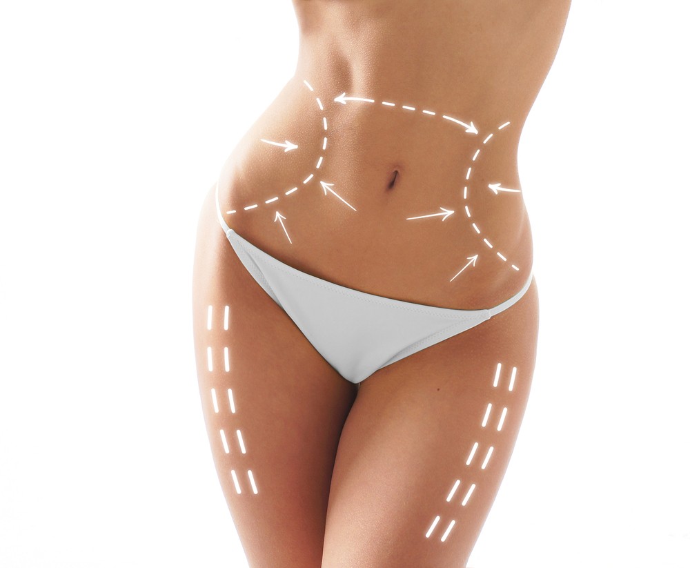 What is Body Contouring?