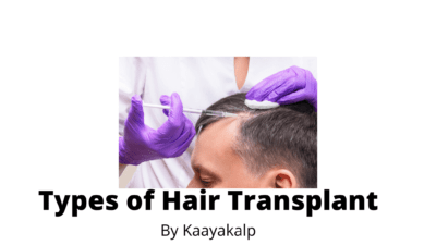 Types Of Hair Transplant