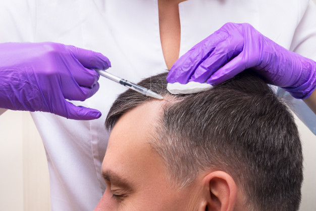 Is Hair Transplant the Right Option?