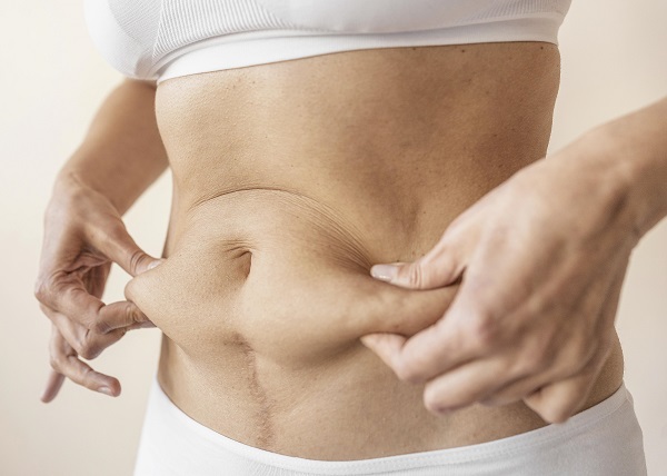 What to expect after liposuction?