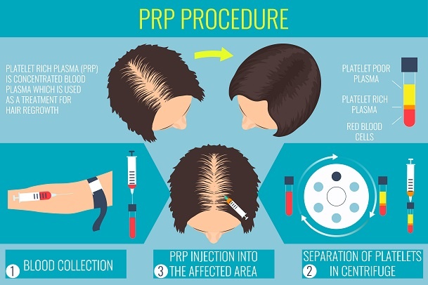 Therapy For Hair Restoration
