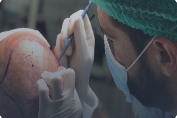 How to become a hair transplant surgeon?