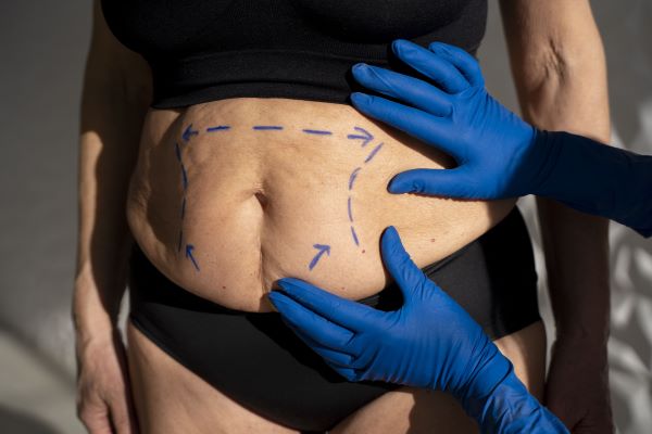 Pros and Cons of Body Contouring Treatments: Things You Should Know